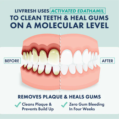 LIVFRESH Gel Toothpaste Wintergreen Foaming